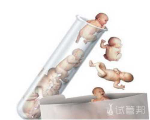 兰州代孕正规机构 兰州试管婴儿医生介绍 ‘4孕囊大小看男女’