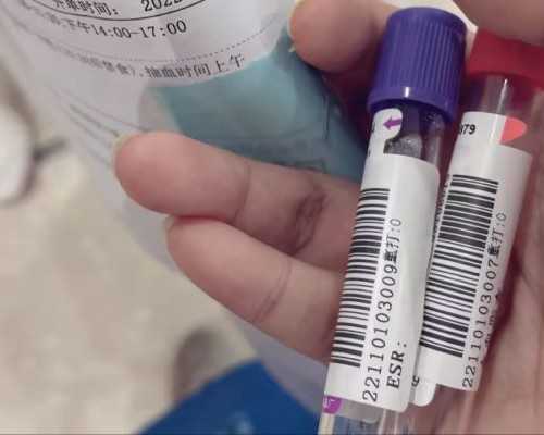 甘肃试管婴儿补贴多少,甘肃哪家试管婴儿医院好?