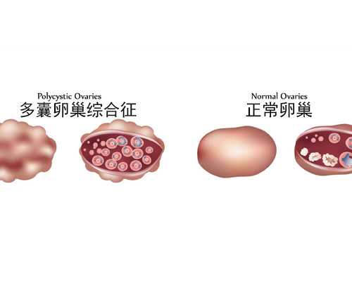 杭州地下供卵怀孕安全吗 杭州红会医院试管婴儿成功率是多少?一次试管能够成