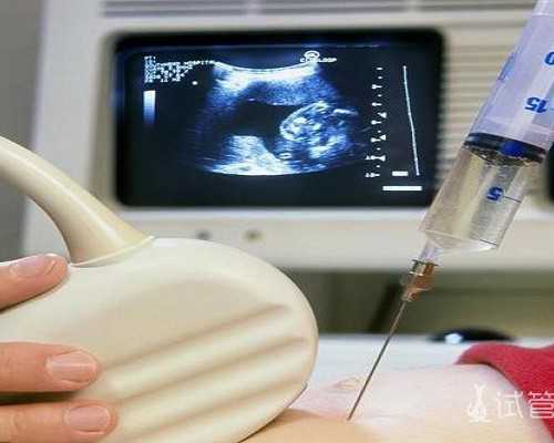 武汉做试管多少钱?