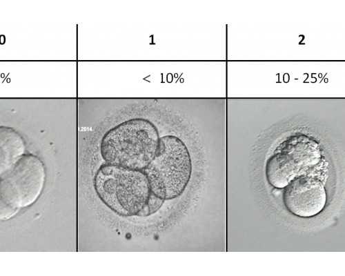 南昌第三代试管代孕选 南昌试管婴儿条件如下 ‘营口伊人26周四维看男女准么