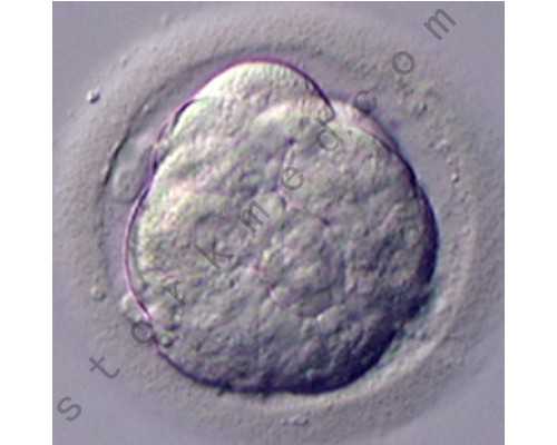 甘肃哪里可以冷冻卵子?,2023甘肃月子中心十大排行