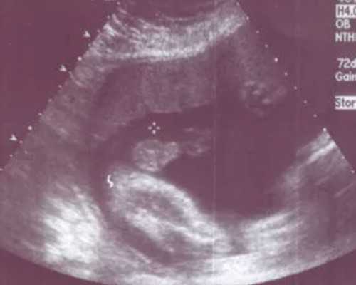 武汉供卵试管中心名单权威发布,在武汉做试管婴儿结果基础卵泡很少，我该怎