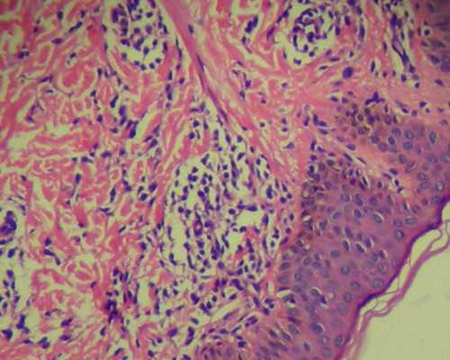 甘肃供卵市场 甘肃试管婴儿补助政策最新消息 ‘b超单心率如何看男女’