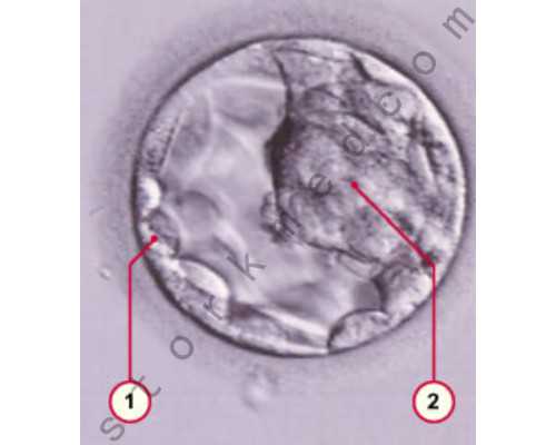 深圳供卵试管费用多少钱,深圳北大不排队做供卵三代试管婴儿费用明细是怎样