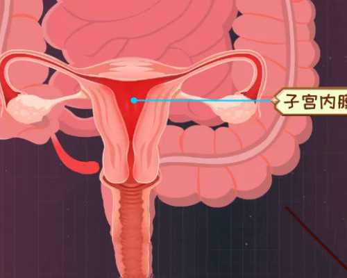 备孕期间得了湿疹怎么办