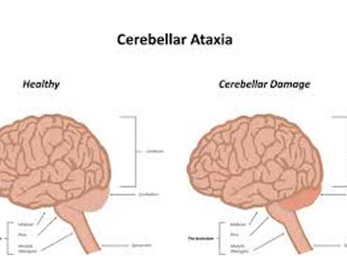 武汉借卵三代试管,武汉供卵春晖失败,武汉春晖供卵地址