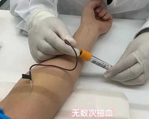 甘肃金牌供卵试管 甘肃做试管婴儿需多少钱? ‘三维看男女,下面两条线’