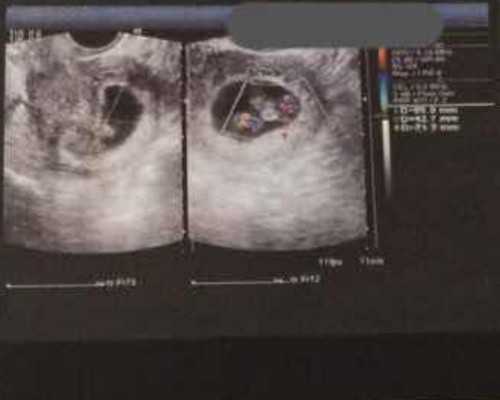 三代试管成功后可以做的那些副业