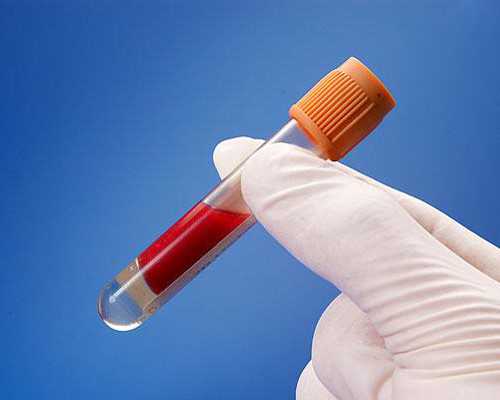 武汉借卵子代生,武汉供卵春晖,武汉供卵试管