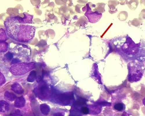 武汉供精人授成功案例,武汉助孕骗局案例