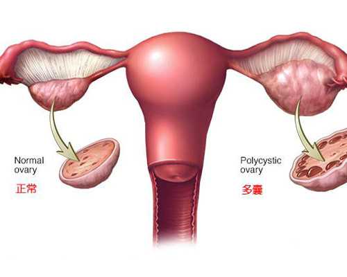 武汉代怀包男孩价格,武汉供卵春晖,武汉供卵试管