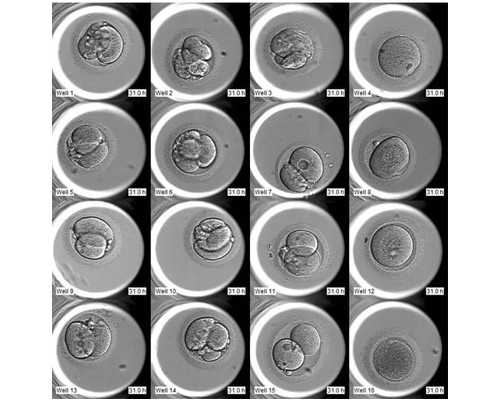 甘肃省妇幼保健院基本信息,兰大二院生殖医学科成为甘肃省首家“全国女性卵