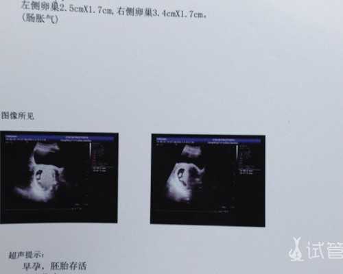 武汉代生全包价,武汉正规供卵试管医院,武汉正规供卵机构