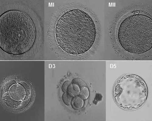 武汉代孕公司电话|如何快速完成武汉三代试管婴儿流程?