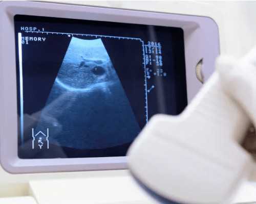 兰州助孕在哪里_代孕和试管|张家口试管一二三代多少钱