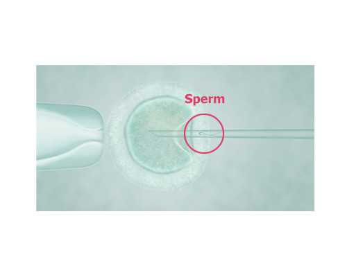 深圳供卵试管可以包成功吗,2022北大深圳医院试管婴儿费用明细分享，三代供卵