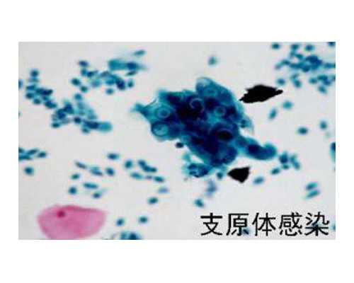 兰州供卵靠谱吗 兰州做一次试管婴儿多少钱 ‘孕囊公式看男女’