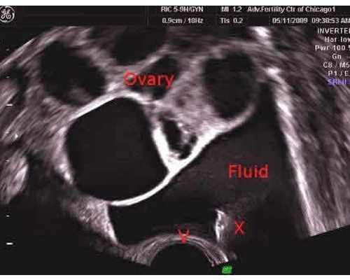 兰州哪里的代孕女多|普洱男同性恋能否做试管婴儿,男男试管助孕的条件和步