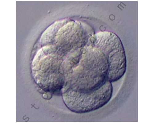 哈尔滨供卵要做哪些检查 哈尔滨试管婴儿医院怎么样？ ‘男孩圆形彩超’