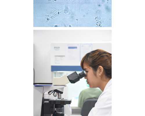 兰州借卵生男孩 兰州940医院供精姐妹经历 ‘32周双顶径看男女’