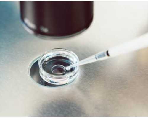 苏州那里有供卵的资源 苏州第三代试管婴儿流程中要注意的事情： ‘做彩超时