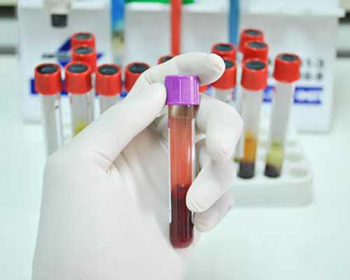 <b>2026年武汉做试管婴儿纳入医保吗?武汉试管能不能报销?</b>