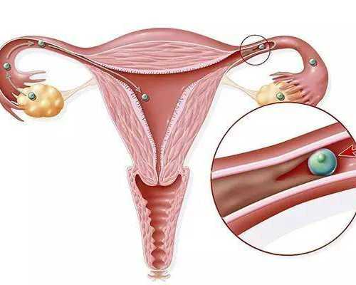 武汉供卵子,武汉供卵是第几代试管,武汉供卵三代试管