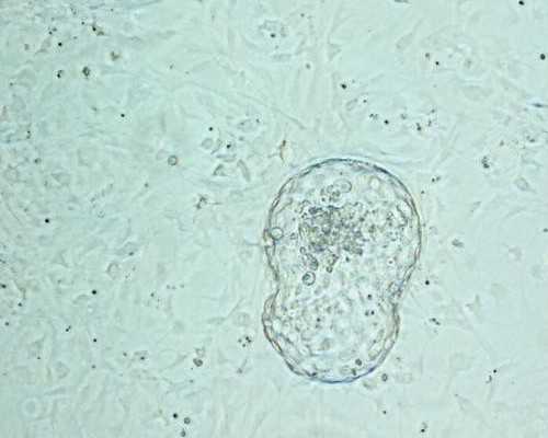 武汉靠谱代怀公司,武汉供卵试管费用（武汉试管婴儿捐卵供卵）