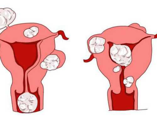 甘肃老婆生孩子可以用老公的社保么,甘肃助孕价格,甘肃**男孩,甘肃**妈妈