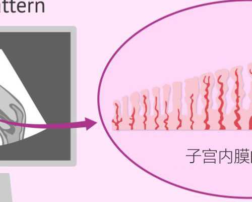2023甘肃试管费用是否纳进医保?,甘肃九院试管婴儿费用如何