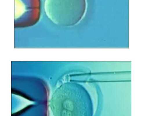 青岛借卵生子有吗 青岛市立医院生殖科医生介绍 ‘七个月男孩和女孩b超有什么