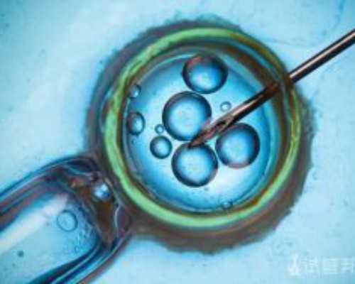 甘肃借卵子试管 甘肃省政府对失独家庭做试管婴儿会有补贴吗? ‘一个月b超单