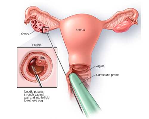 2023
年武汉做试管婴儿纳入医保吗?武汉试管能不能报销?