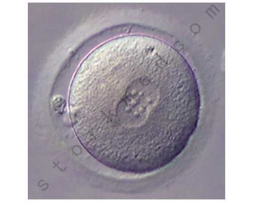 甘肃集爱做三代试管婴儿可以确定胚胎性别选男女吗？