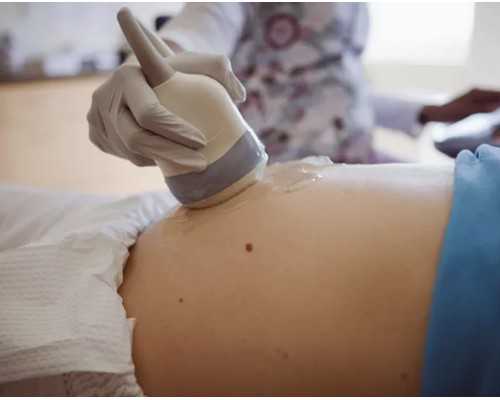 杭州供卵在线咨询 2022最新杭州私立供卵机构排名出炉 ‘怀女儿的孕囊形状图片