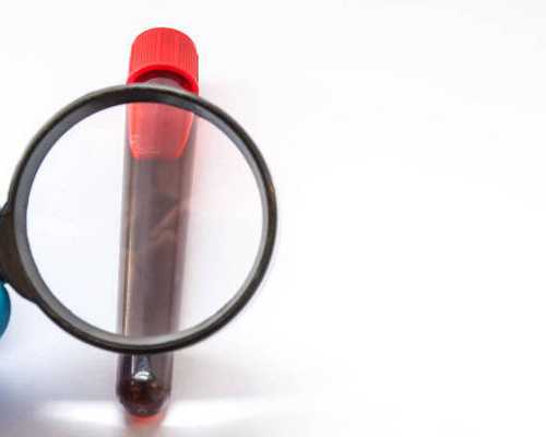 厦门代孕服务介绍 2022厦门试管费用纳入医保了吗? ‘股骨长25FL,三个月二十天