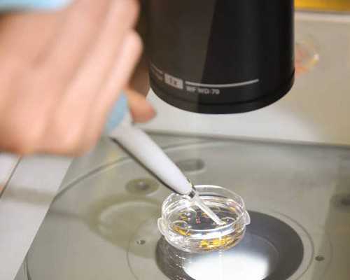 武汉哪里可以冷冻卵子,武汉做试管哪里好？