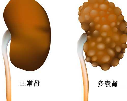 江苏男男代生孩子 江苏省妇幼供卵生子的适应症一览 ‘怎么查b超单上的是男是