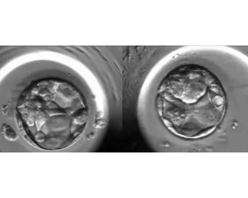 人工授精成功率最高的医院甘肃人工授精比较好的医院是哪个？甘肃哪个医院做