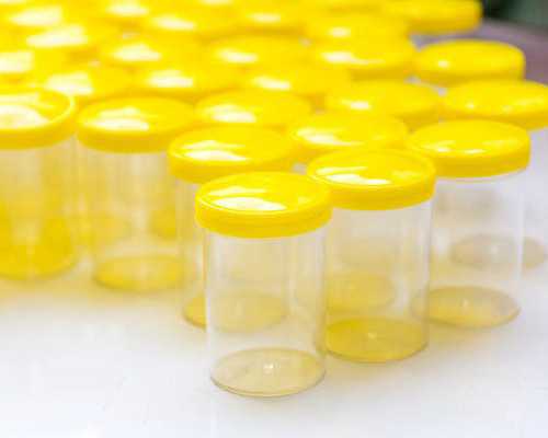 备孕期间如何提高卵子的质量？