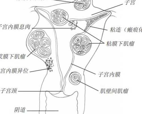武汉供卵代生在哪|武汉同济生殖中心试管成功率高吗