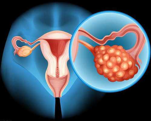 杭州职业代怀包生子 杭州做试管婴儿多少钱 ‘怀男宝宝妈妈特征’