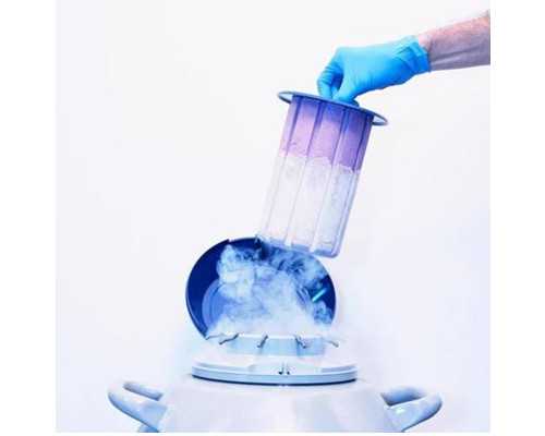 哈尔滨供卵哪家好 哈尔滨姐妹三代试管安排： ‘识别b超男女图’