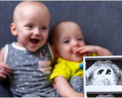 多囊卵巢2年，在甘肃酒泉做试管婴儿成功率有多高？