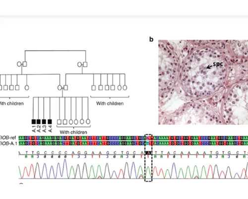 武汉做试管三代男孩几率高吗 武汉做试管婴儿可选择医院较多 ‘双顶径偏小已