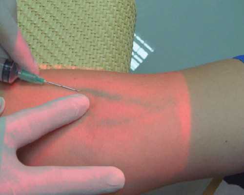 武汉助孕流程介绍 2023不孕患者在武汉做人工授精要多少钱？附武汉人工授精生