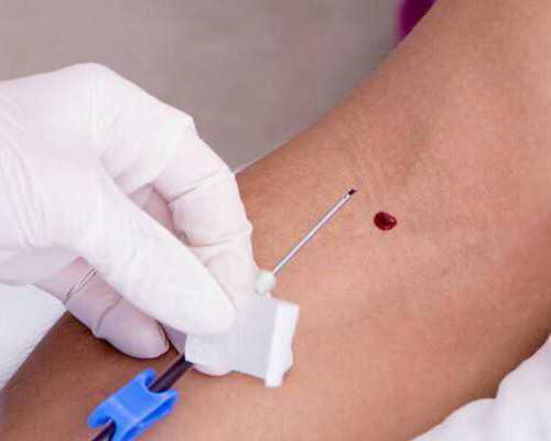 2023
年武汉做试管婴儿纳入医保吗？武汉试管能不能报销？