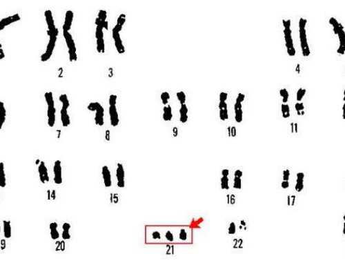 昆山代腹生子 昆山中医院试管做试管婴儿要知道哪些事儿？ ‘酒精测男女是什