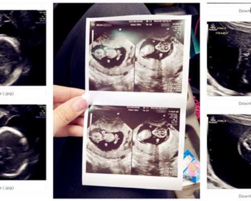 武汉可以试管吗最新消息,武汉试管大概需要多少钱